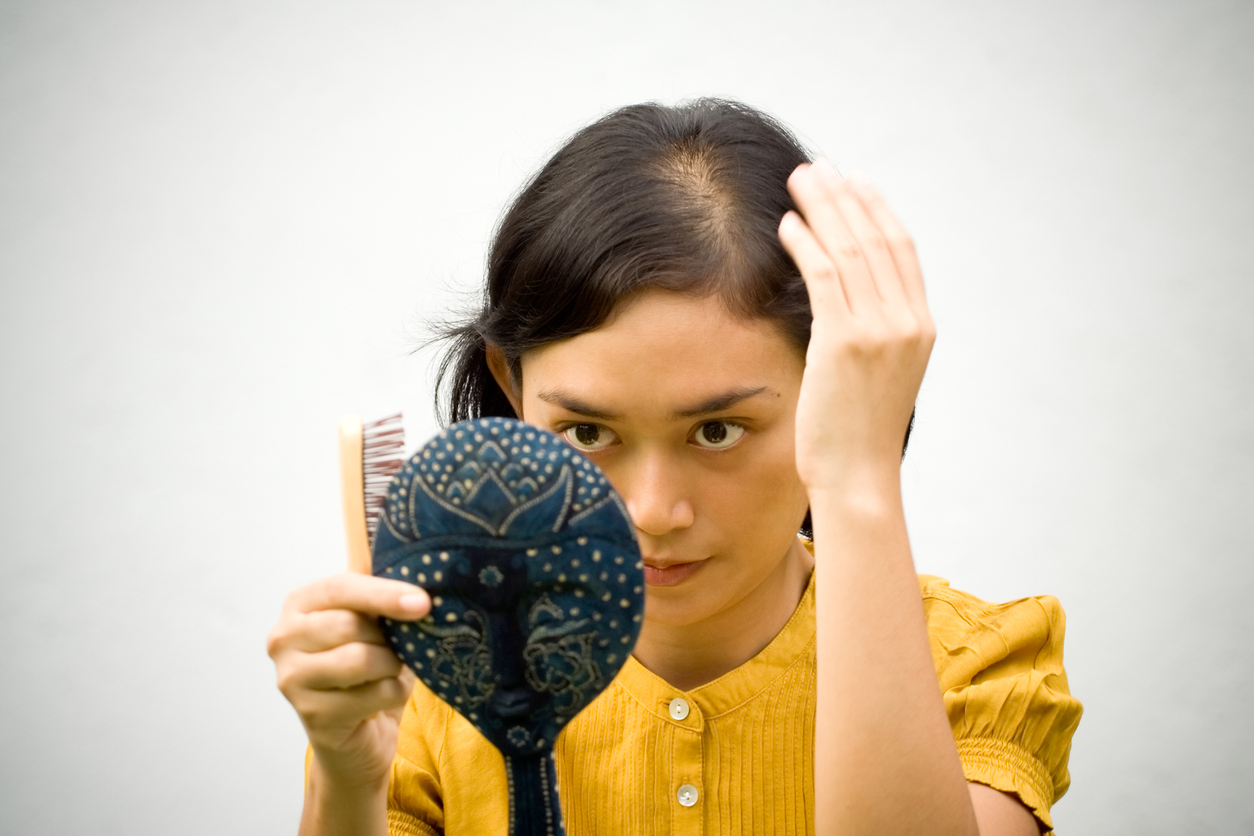hair loss in women featured