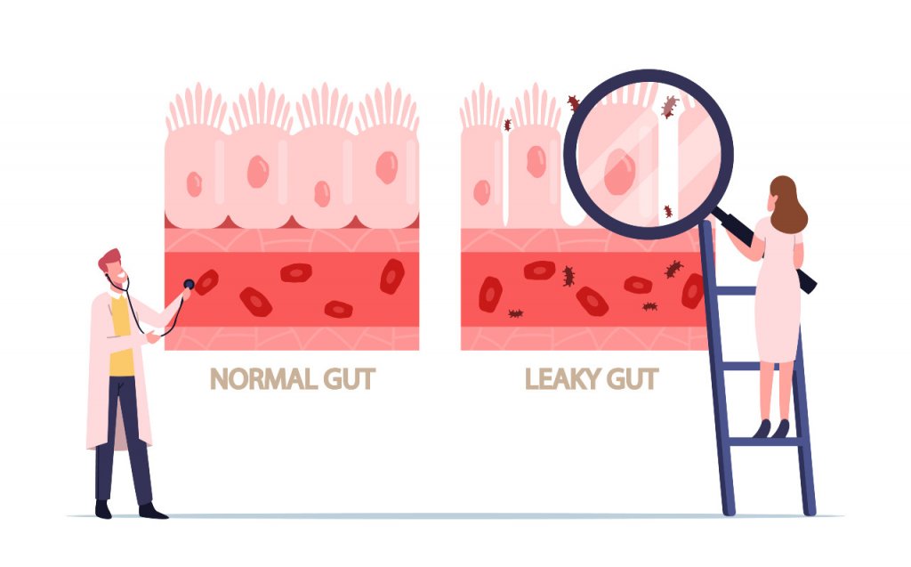 what is leaky gut syndrome illustration