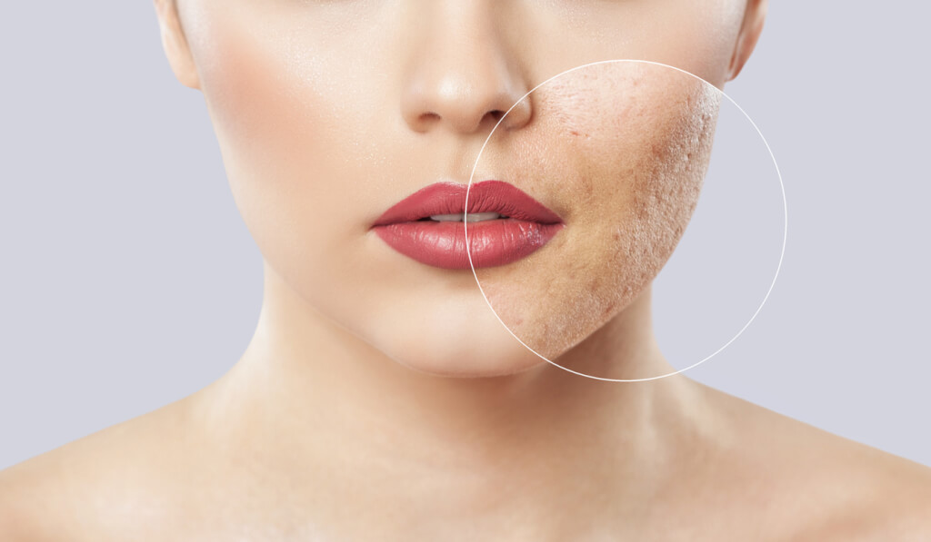 most common skin care mistakes