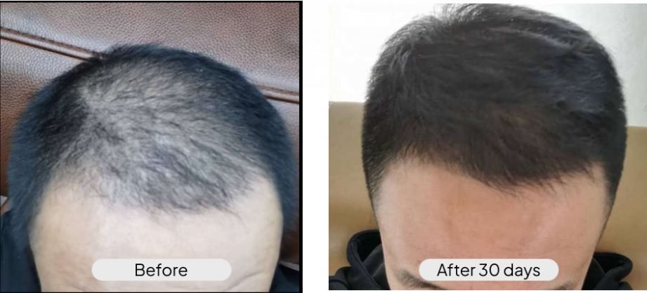 before-after