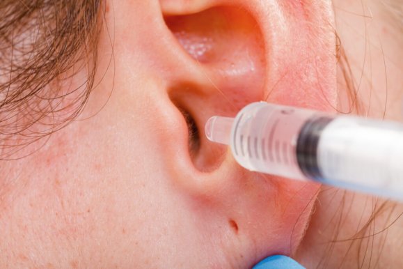 4 of the best earwax removal products