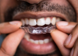 Ceramic braces or Invisalign: Which clear braces are right for you?