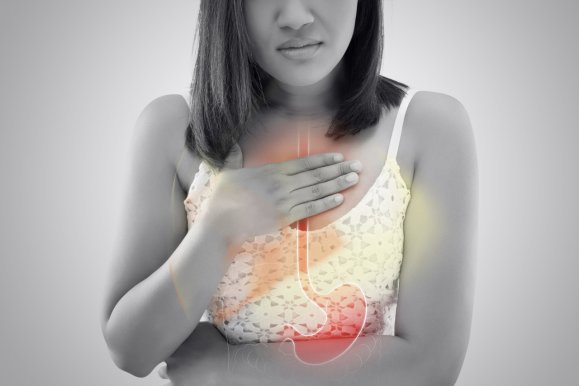 Natural ways to treat and prevent gastroesophageal reflux disease (GERD)