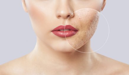 The 7 most common skin care mistakes, according to a dermatologist