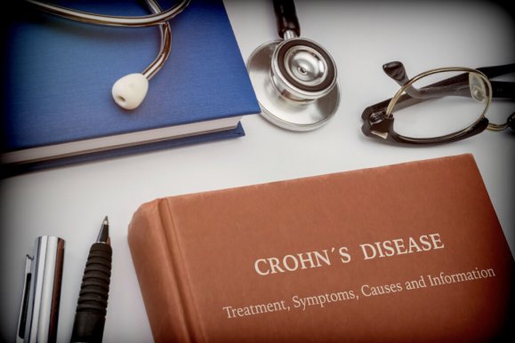 Crohn’s disease: what you need to know